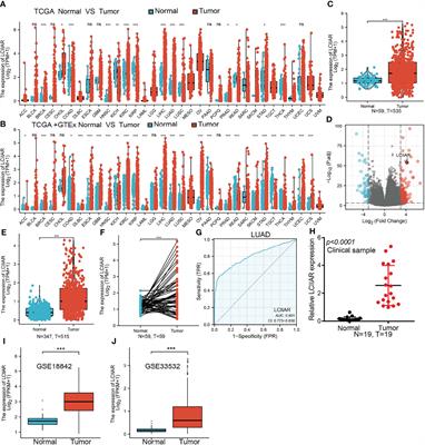 Identification and Validation of Long Non-Coding RNA LCIIAR as a Biomarker in LUAD